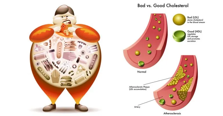 Cholesterol తగ్గించే డైట్ ప్లాన్: రోజువారీ ఆహార సూచనలు